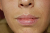 lips-before2